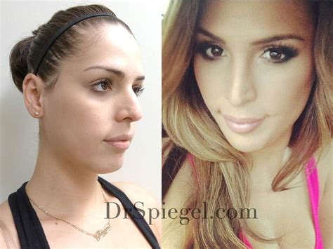6 jaw and chin contouring the goal is to make the chin appear 9 fascinating facts about
