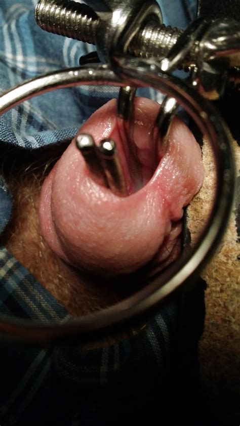urethra gaping 10 pics xhamster