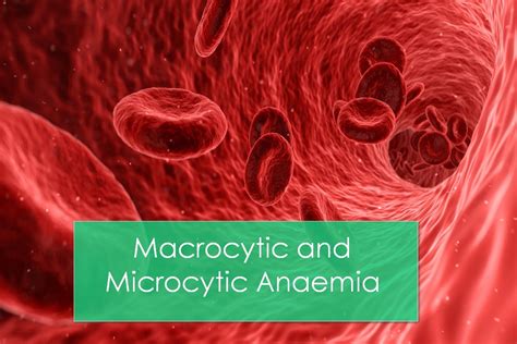 macrocytic and microcytic anaemia medcrine