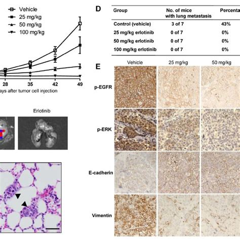 Erlotinib Inhibited Tumor Growth And Metastasis In A Sum149 Xenograft