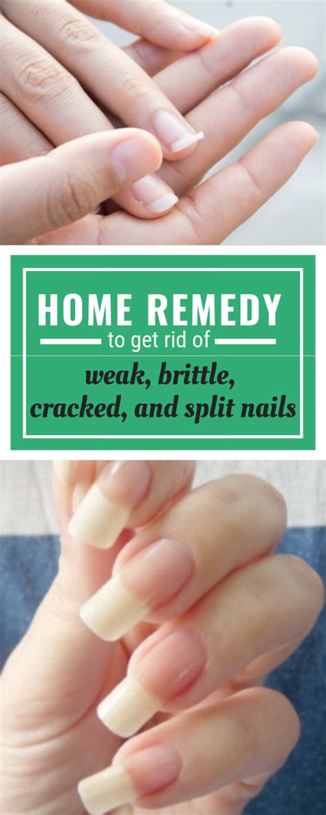 best home remedy to get rid of weak brittle cracked and