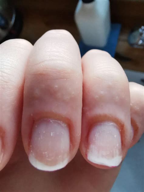 experts warn  life long effects  nail gel polish