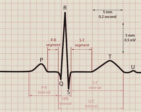 Normal Ecg Labeled Normal Ecg Tracings Comprise Cardiology Pr