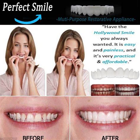cosmetic dentistry snap on smile instant smile comfort fit flex