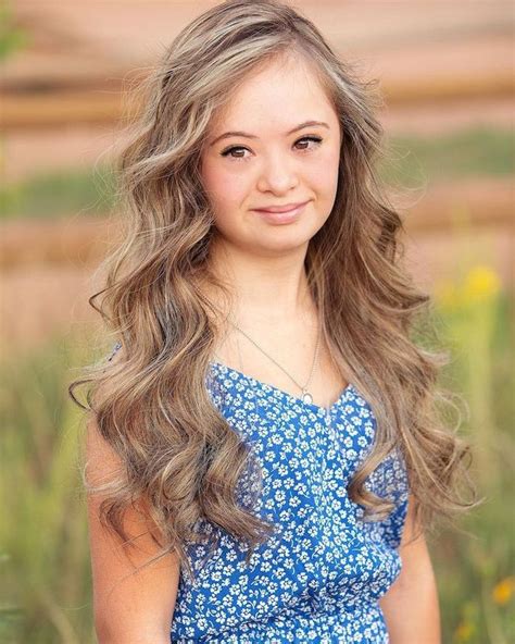 Teen Model With Down Syndrome Is Breaking Barriers With High Profile