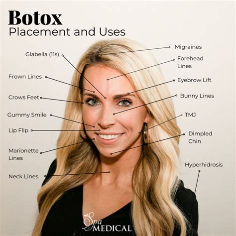 botox     work spa medical