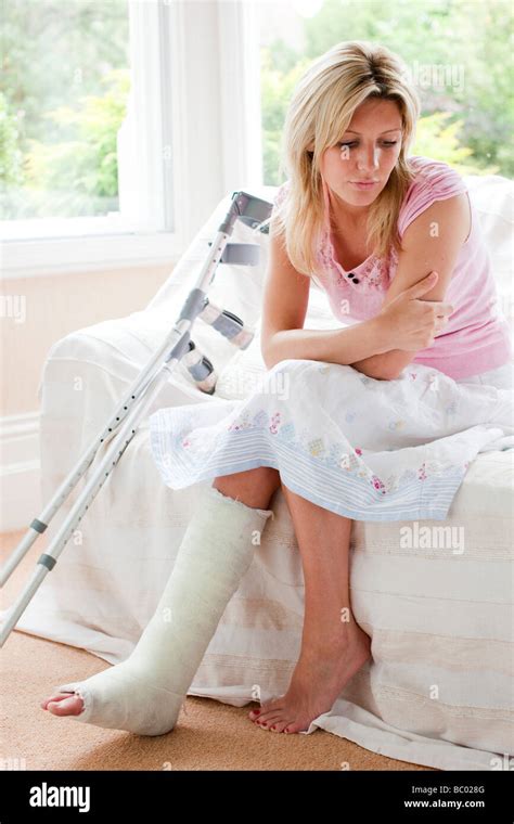 woman  broken leg stock photo alamy