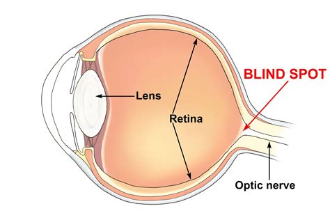 blind spot   eye