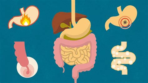 9 Common Digestive Conditions From Top To Bottom Everyday Health