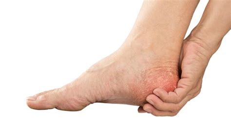 what causes foot numbness in runners active