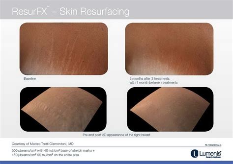 Anal bleaching and dermatologist and california