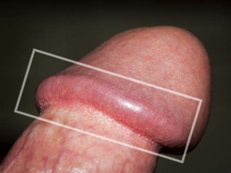 weird shaped vagina mega porn pics