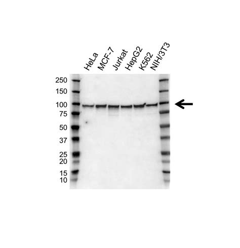 anti ewsr antibody precisionab polyclonal antibody bio rad