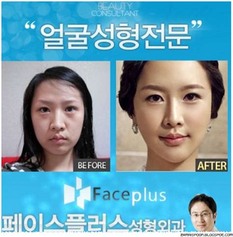 Cik Ain Bedah Foto Sebelum Dan Selepas Wanita Korea Buat