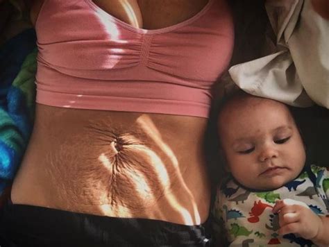Stomach Skin Wrinkles After Pregnancy Photo Goes Viral After Brave