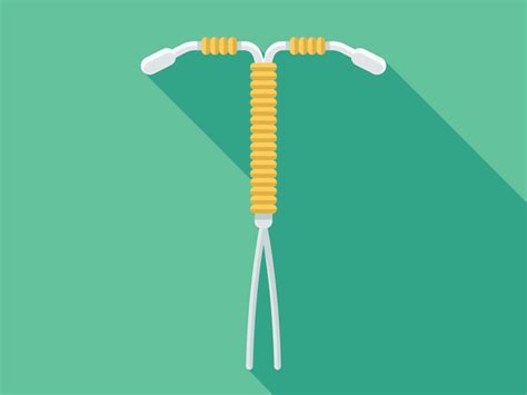 Can My Iud Fall Out If I Have Rough Sex