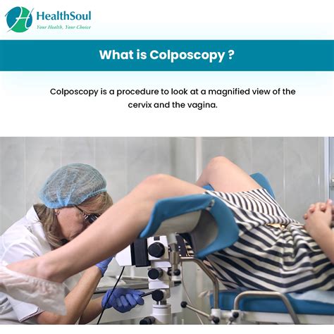 Colposcopy Indications And Complications – Healthsoul