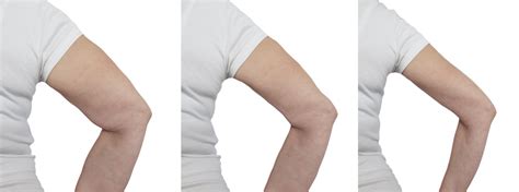 3 Easy Exercises To Quickly Transform Flabby Arms In 30 Days Reset