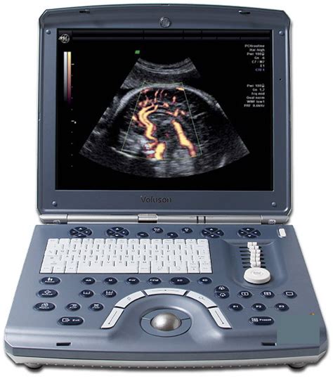 ultrasound voluson