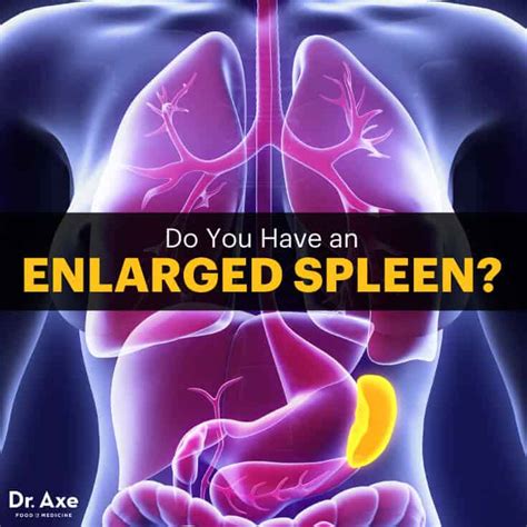 enlarged spleen symptoms warning signs  treatments dr axe