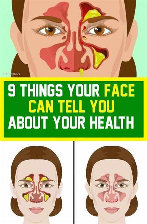 9 things your face can tell you about your health told you so face