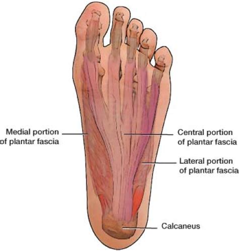 Plantar Fasciitis And Other Abnormalities Of The Plantar Fascia
