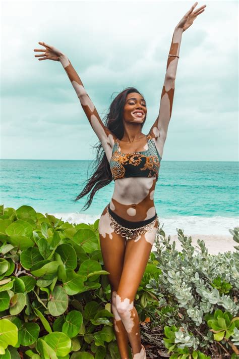 winnie harlow fappening topless 10 photos the fappening
