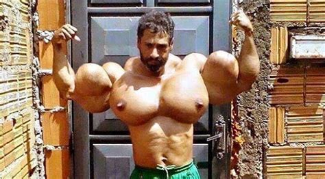 bodybuilders  allegedly  synthol muscle fitness