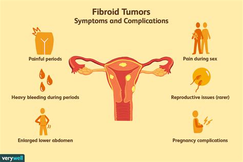 fibroid  pregnancy characteristics complications  management pregnancywalls