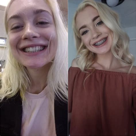 [anastasia knight 18] anyone looking forward to some brace face and teen