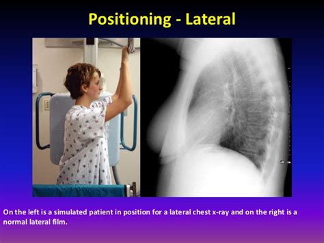 Fundamentals Of Chest Radiology