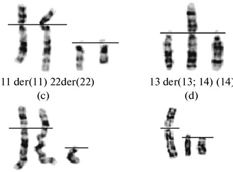 examples of structural and numerical chromosomal abnormalities detected download scientific