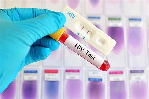 Sti And Std Testing Procedure Information For Men And Women