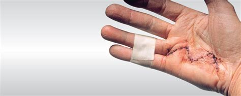 plastic surgeon hand specialist kolkata plastic  hand surgery clinic