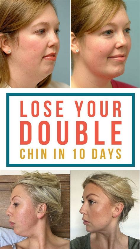 How To Get Rid Of A Double Chin The Quick And Easy Way In