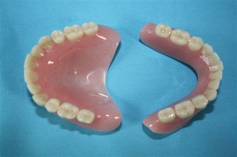 volledige gebitsprothese   tandtechniek