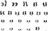 Karyotype Ascs Cryopreserved Passage sketch template