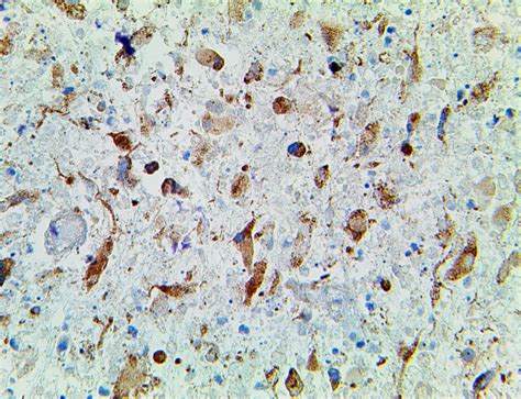 idh rh antibody ihc bio sb