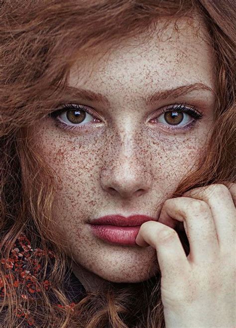 15 freckled people who ll hypnotize you with their unique