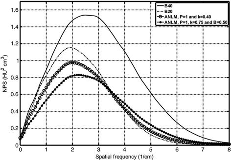 noise power spectrum analysis   commercial reconstruction kernels  scientific