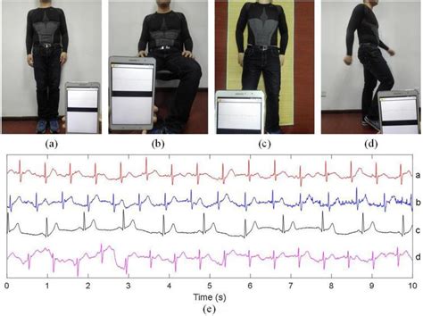 Design Of A Smart Ecg Garment Based On Conductive Textile Electrode And