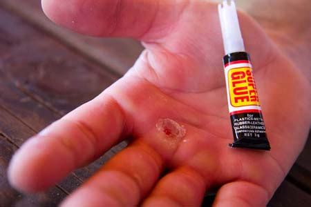 super glue  skin  ultimate tips  remove  completely
