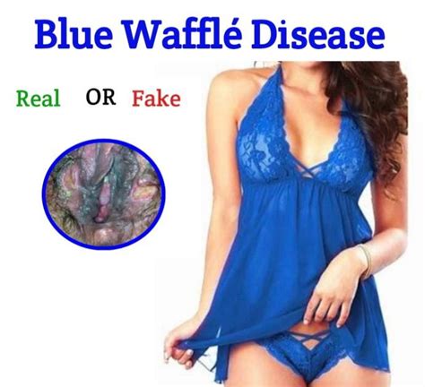 Blue Waffle Disease Public Health