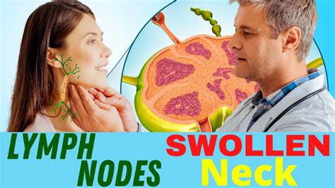 lymph nodes   face stoll design