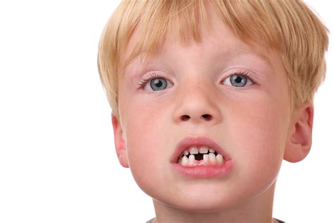 child insecure  missing teeth dr scott