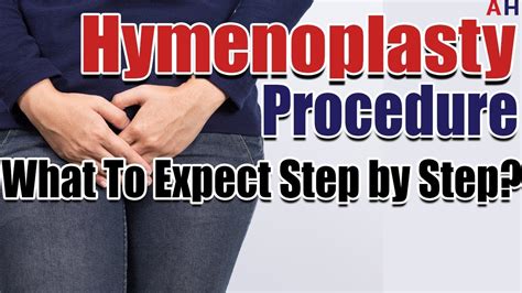 hymenoplasty procedure what to expect step by step during hymen