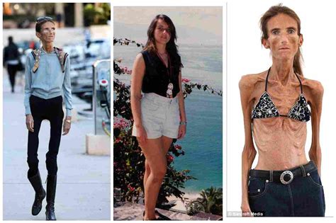 worlds skinniest person top  skinniest person   world