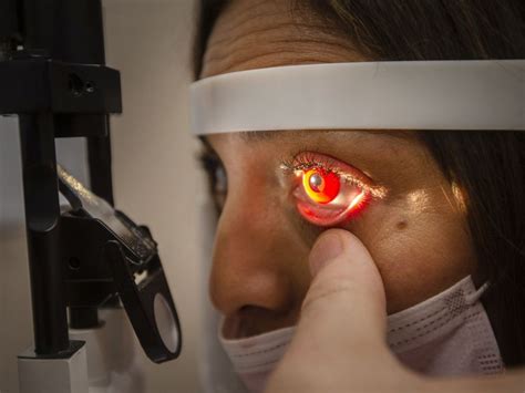 optician warns  costume contact lens dangers windsor star