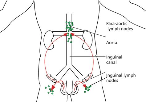 Lymphatic System Testes Inguinal Nodes Inguinal Canal And Para