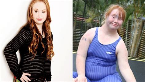 Meet The Young Model Maddy Stuart With Down Syndrome Determined To